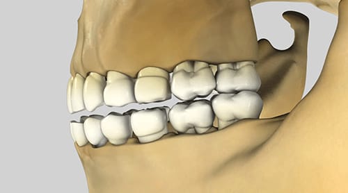 ortho_problems