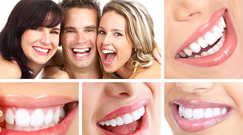 Smile Makeovers