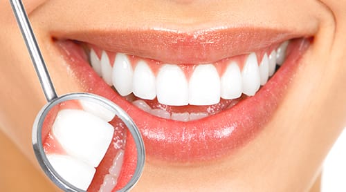 SnapOn Smile