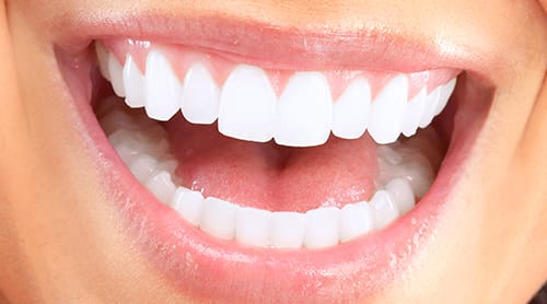 Soft Tissue Grafting
